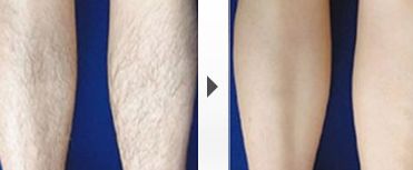 上海頂尖整形外科專(zhuān)家排行榜名單曝光！實(shí)力強(qiáng)弱一目了然！