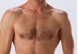 成都整容醫(yī)生吳開泉鼻部整形手術(shù)真實(shí)案例！