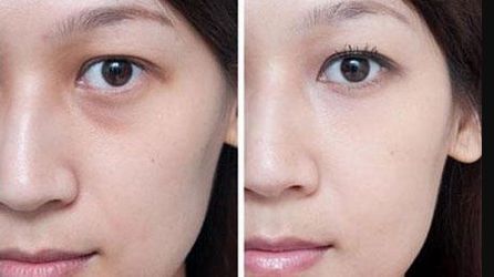 哪家醫(yī)院在大連揚(yáng)名于胸部整形？