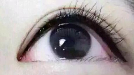 深圳哪家醫(yī)院割雙眼皮效果更好？值得推薦！