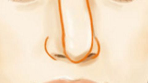 南京私密整形——關(guān)于這個你或許不知道的小秘密