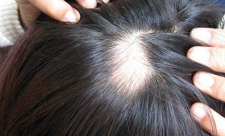 深圳藝星整形醫(yī)院口碑如何？哪位醫(yī)生技術(shù)出眾？收費明細怎么樣？