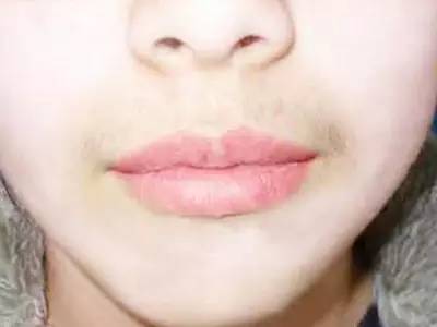 無錫三院整形科哪位醫(yī)生會更受關(guān)注？