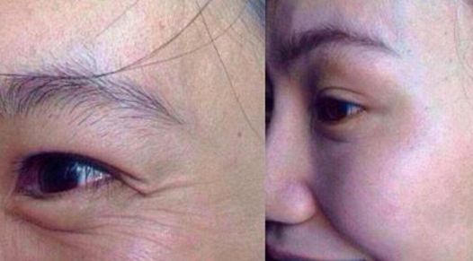 北京空軍總醫(yī)院優(yōu)秀整形美容專家推薦，4位公認(rèn)人氣高！