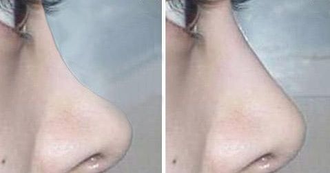 無錫最新醫(yī)美熱門！高人氣整形醫(yī)院揭秘，信譽(yù)在線！