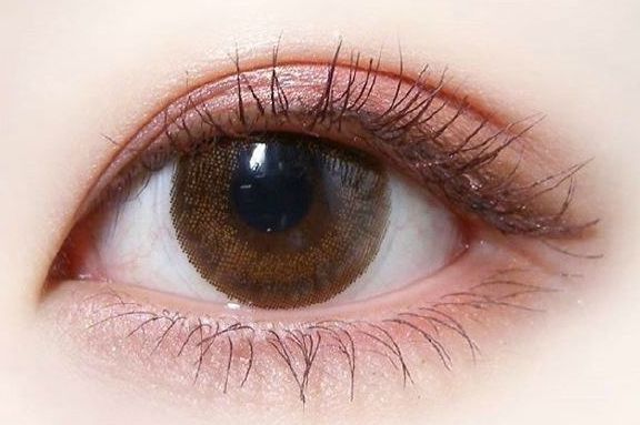 做雙眼皮的技術及效果，近年治療體驗發(fā)布解析