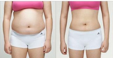 廣州優(yōu)秀整形醫(yī)院排名前三，看看美恩、荔醫(yī)、曙光的口碑如何