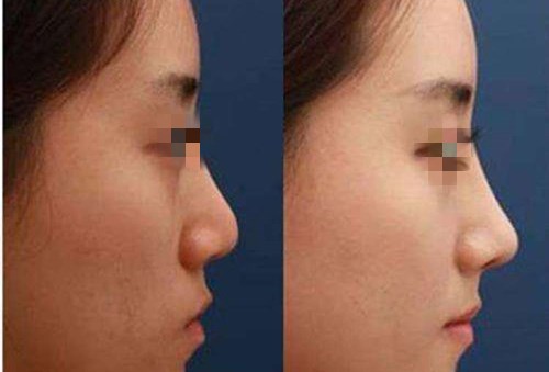 重慶愛思特整形美容醫(yī)院團(tuán)隊(duì)的技術(shù)一覽，值得信賴嗎？