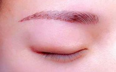 北京打玻尿酸首選！猛戳熱搜榜，解鎖姐妹們的心聲！