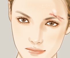 哪家醫(yī)院是國(guó)內(nèi)顴骨整形的佼佼者？九院，華西，西京等整友們贊不絕口！