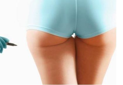 廣州權威吸脂醫(yī)院推薦，技術卓越不可錯過！