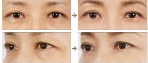 濟(jì)南省立醫(yī)院靚麗容顏新匯價(jià)，專家團(tuán)陣容揭曉