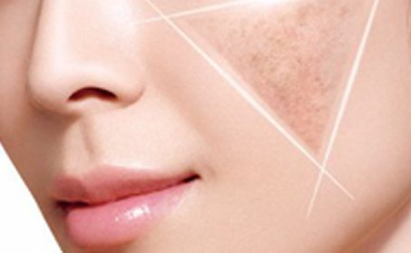 卿勇隆鼻效果如何？專家所屬醫(yī)院披露