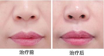 最靠譜的蘇州下頜角整形醫(yī)院推薦，口碑爆棚的醫(yī)療機構(gòu)評選