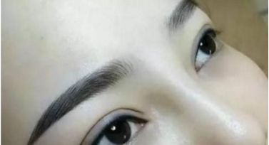 北京哪個醫(yī)院治療胎記效果好？這家醫(yī)院備受推崇