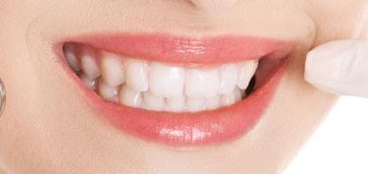 2023年一覽廈門最新雙眼皮醫(yī)療機(jī)構(gòu)-替代列表中，星系、顏王等上榜，自主選擇美容服務(wù)！