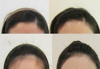 上海久愿整形醫(yī)院：醫(yī)術(shù)高超的專家團(tuán)隊及服務(wù)費用展示