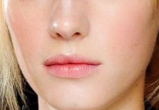 鄭州二附院馬富廉醫(yī)院特點(diǎn)揭秘！下頜角磨骨案例詳解！