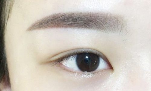 高水準(zhǔn)醫(yī)生為您解密寧波楊加峰雙眼皮術(shù)的案例與技術(shù)！