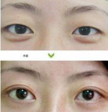 成都哪些醫(yī)生能力出眾進(jìn)行隆胸術(shù)？年度隆胸好醫(yī)生十大排名出爐