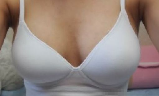 天后朱東磊鼻子整形效果如何？專家評估結(jié)果公開解析