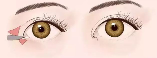 2023年福州整形醫(yī)院預(yù)計將迎來新的變革！