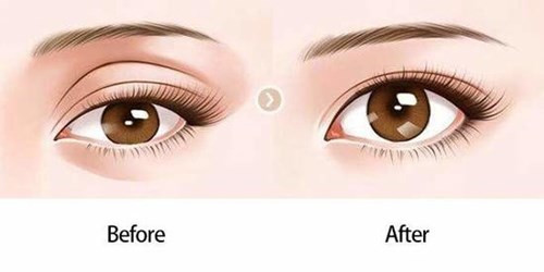 邯鄲哪家醫(yī)院能夠有效改善厚唇問題？如何選擇醫(yī)院？