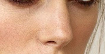 西安哪家醫(yī)院治療雙眼皮效果專業(yè)？達(dá)人推薦，好口碑！