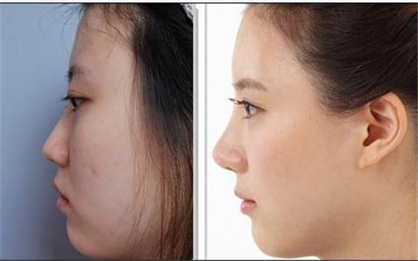 常州市中醫(yī)院是一家有哪些優(yōu)勢(shì)的醫(yī)美整形醫(yī)院呢