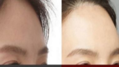 廈門哪些醫(yī)院擁有的抽脂技術(shù)，等你來發(fā)現(xiàn)