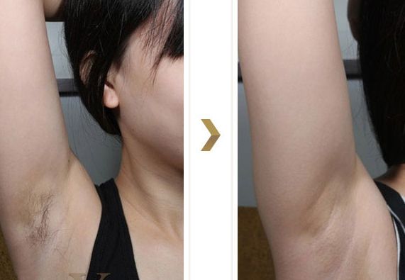 浙一整形美容科名醫(yī)范希玲解析，精湛技藝助您完美蛻變！