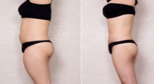 重慶五家優(yōu)秀整形醫(yī)院，值得推薦的附一院和聯(lián)合麗格！