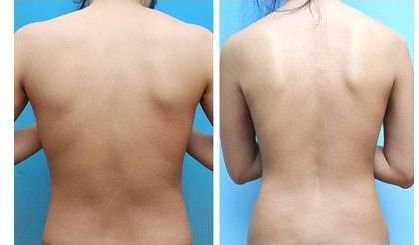 2023年長沙地區(qū)推薦的面部拉皮除皺醫(yī)生排行榜公開醫(yī)生背景介紹詳細(xì)版