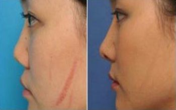 蘇州最佳雙眼皮整形醫(yī)生TOP5：專業(yè)推薦！