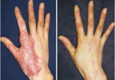 深圳市綜合整形醫(yī)院排行榜，口碑好的醫(yī)療機(jī)構(gòu)大揭秘！