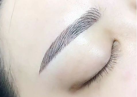 激光煥膚中心：祛眼袋效果有口皆碑，多位專(zhuān)家力薦