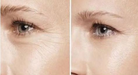 2023最佳杭州雙眼皮整形醫(yī)院排行榜揭曉！讓你雙眼瞬間變迷人的十大選擇！