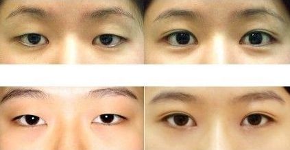 上海五位頂級(jí)整形專家鼻王盤點(diǎn)，你無法想象的專業(yè)能力，只有你才知道的顛覆美麗！