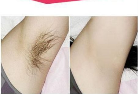 鄭大一附院整形科：專家門診時(shí)間及預(yù)約價(jià)目參考