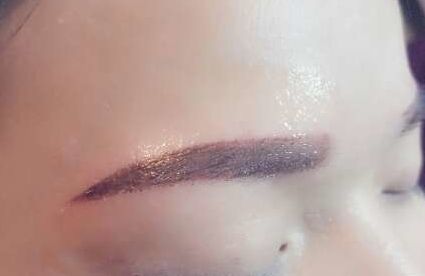 嘉興哪家雙眼皮整形醫(yī)院技術(shù)實(shí)力超群，備受矚目！