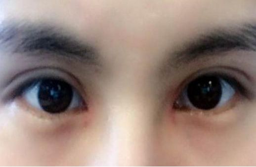 專家執(zhí)針絕活，您知道哪位醫(yī)生在注射物取出方面最厲害嗎？獨(dú)特手法排行榜前五名大揭曉