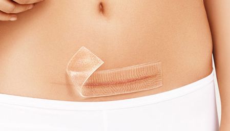 上海九院王琛隆鼻術(shù)后圖及專家簡介，完成理想的鼻梁不再遙不可及！