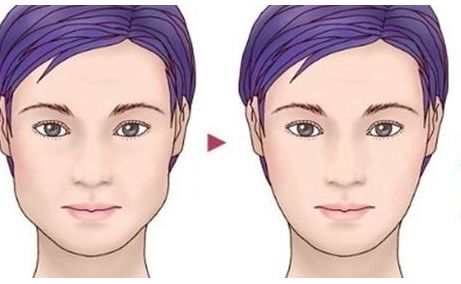 上海著名整形醫(yī)生李圣利的鼻子審美效果如何？網(wǎng)友親身經歷分享實例。