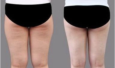 上海頂尖整容醫(yī)師團隊曝光：專為改善臉型而生！