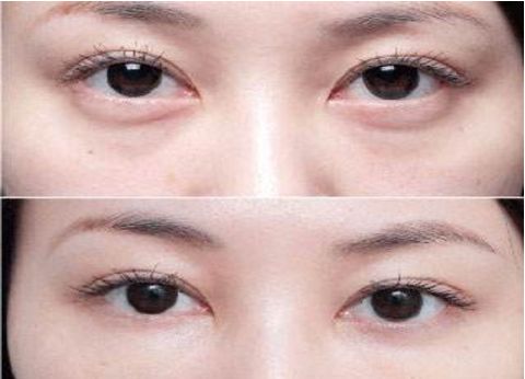 杭州專業(yè)整容醫(yī)療機構(gòu)排行榜大揭秘！藝術(shù)之星醫(yī)療集團對比時光整形大賽！真實原因還原無遺！