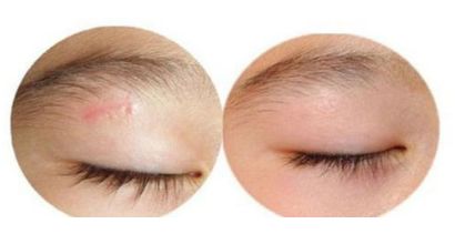 山東省最受推崇的雙眼皮手術醫(yī)院排名公布！專家推薦，精選高評分！