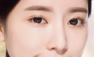 上海薇琳全身吸脂效果好嗎？