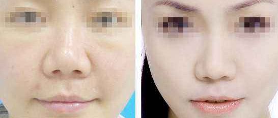 西安整形醫(yī)療機(jī)構(gòu)搶先座次，多家私立醫(yī)美機(jī)構(gòu)震撼效果排在最前！