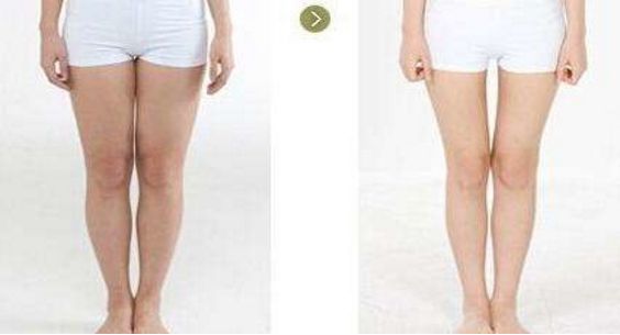 2023年上海副乳吸脂手術(shù)七大名醫(yī)推薦，醫(yī)生排行榜震撼來(lái)襲