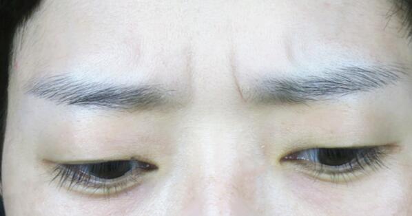 河北醫(yī)科大學(xué)第二醫(yī)院項(xiàng)目有哪些？醫(yī)生技術(shù)如何提供？